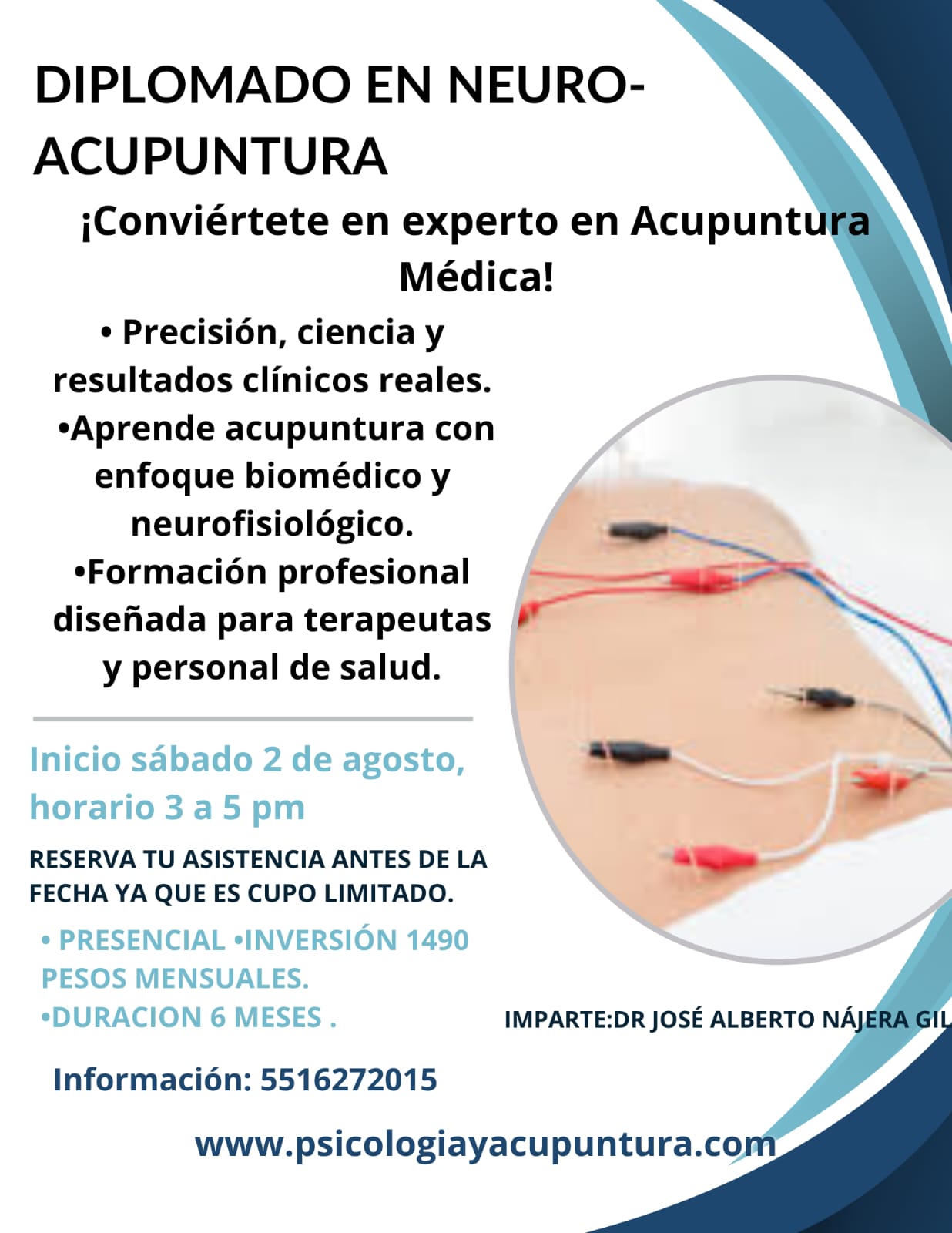 Diplomado en Neuro-Acupuntura
