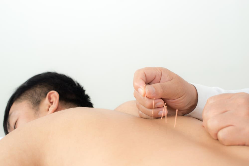 estudio-de-acupuntura-precio.jpg
