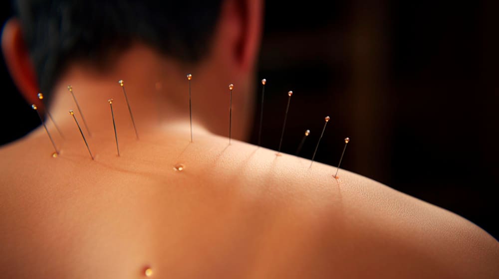 numeros-de-clinicas-de-acupuntura.jpg